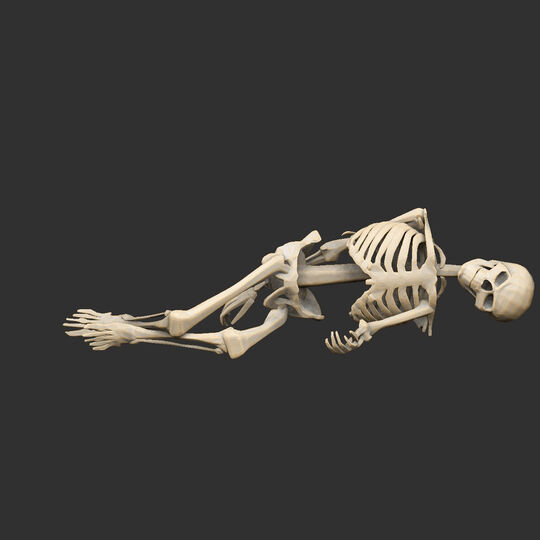Dead Skeletons Posed x4
