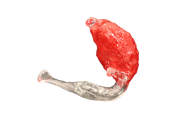 Mandible-Tumor-Resin-Red-2.png