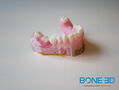 BONE3D 3D printing photo