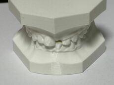 Gebiss_Komplett.jpg
