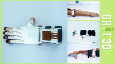 prosthetic-limb-collage3.png