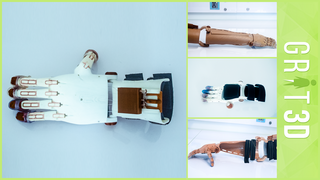 prosthetic-limb-collage3.png