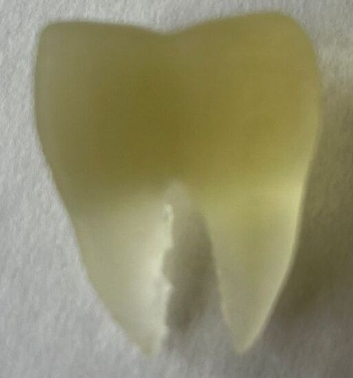 tooth (5).jpeg