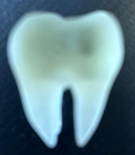 tooth (2).jpg