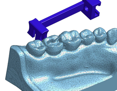 2Toffelmire dental CAD 1.jpg